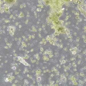 Фазово-контрастное устройство MAGUS SPH360 с набором объективов План ПолуАпохромат Plan S-Apo Ph 4х/10х/20х/40х/60х H60 мм, изображение 15